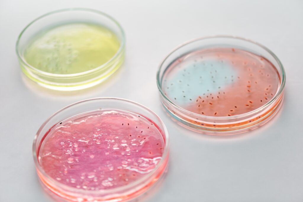 3 bacteria filled Petri dishes in coloured gel of yellow, orange and pink